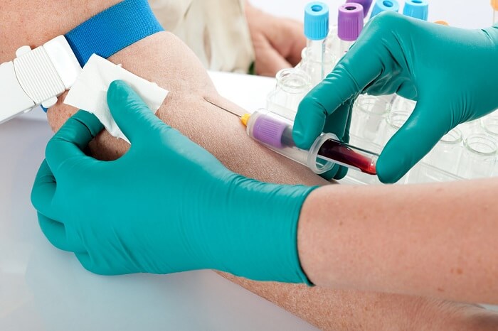 blood test to check testosterone level