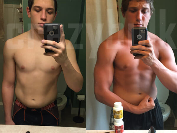 anadrole before and after pic