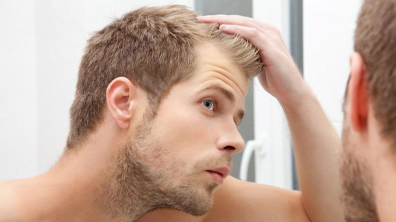 Low Testosterone Can Cause Hair Loss Or Balding