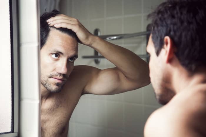 Hair Loss and Steroids